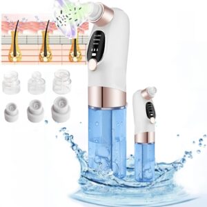 blackhead remover